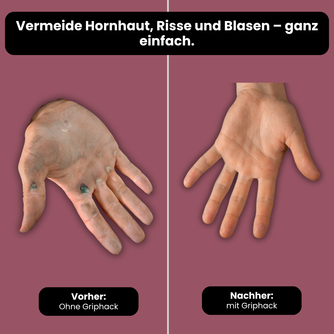 <p>Trainiere ohne schmerzende Hände </p>